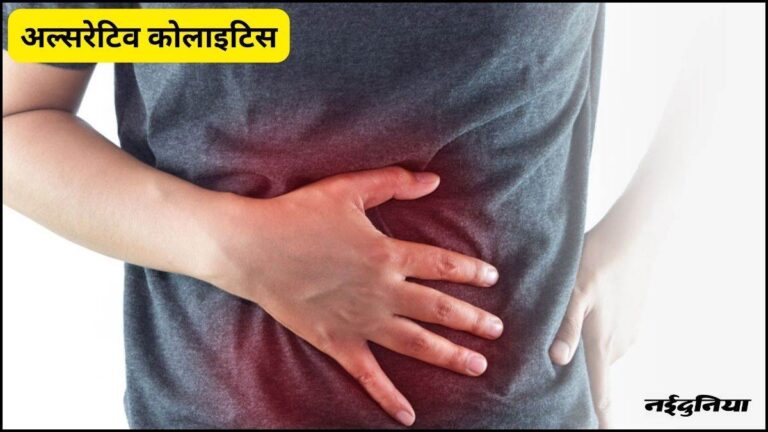 Ulcerative Colitis Signs: पेट दर्द के साथ शौच के दौरान खून आए तो रहे अलर्ट, हो सकती है ये गंभीर बीमारी