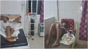 Jabalpur Information : अनूपपुर-मंडला में आकाशीय बिजली गिरने से दो युवकों की मौत, चार झुलसे; सिलेंडर फटने से छह वर्ष का मासूम घायल