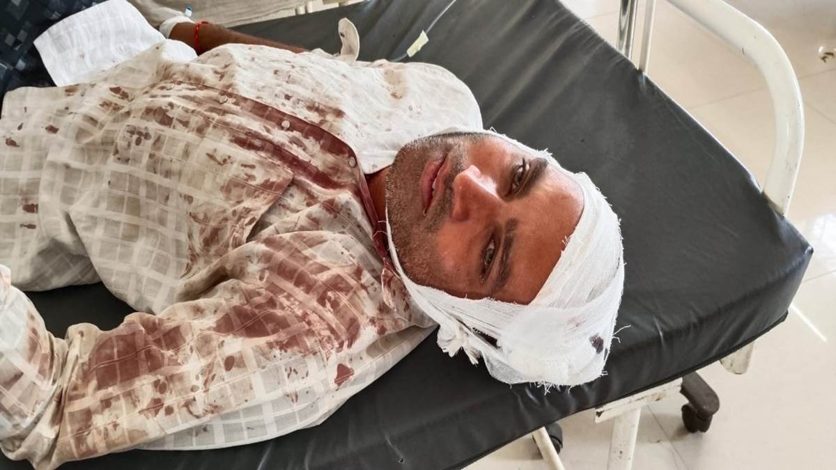 Shivpuri Information: पत्नी को साथ घुमाने फिराने का विरोध किया तो उसके प्रेमी ने फोड़ दिया सिर