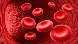 Sickle Cell Illness: अनुवांशिक बीमारी है सिकलसेल, कमजोर हो जाती है इम्यूनिटी, ध्यान रखें ये बातें