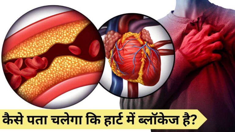 Heart Blockage: घर बैठे कैसे पता लगाएं हार्ट में ब्लॉकेज है या नहीं… यहां जानिए आसान तरीका Heart Blockage: घर बैठे कैसे पता लगाएं हार्ट में ब्लॉकेज है या नहीं… यहां जानिए आसान तरीका