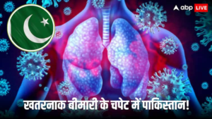 पाकिस्तान कराची श्वसन रोग H1N1 इन्फ्लूएंजा सिंध हेल्थ डिपार्टमेंट अलर्ट