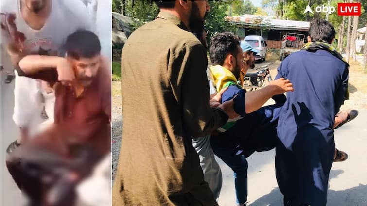 पाकिस्तान में छिड़ा गृहयुद्ध… PoK में सड़कों पर उतरे लोग, निहत्थे कश्मीरियों पर पुलिस ने बरसा